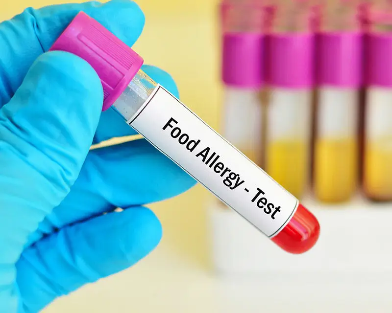 Food & Respiratory Allergy Test at Home in Dubai Life Aid